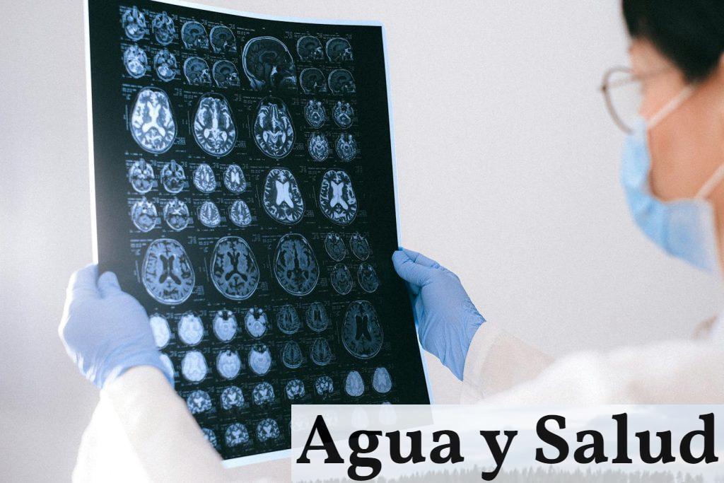 A Doctor Holding an MRI Result of the Brain
