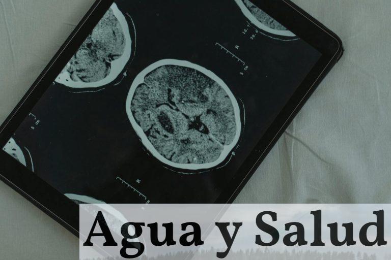 Cerebro