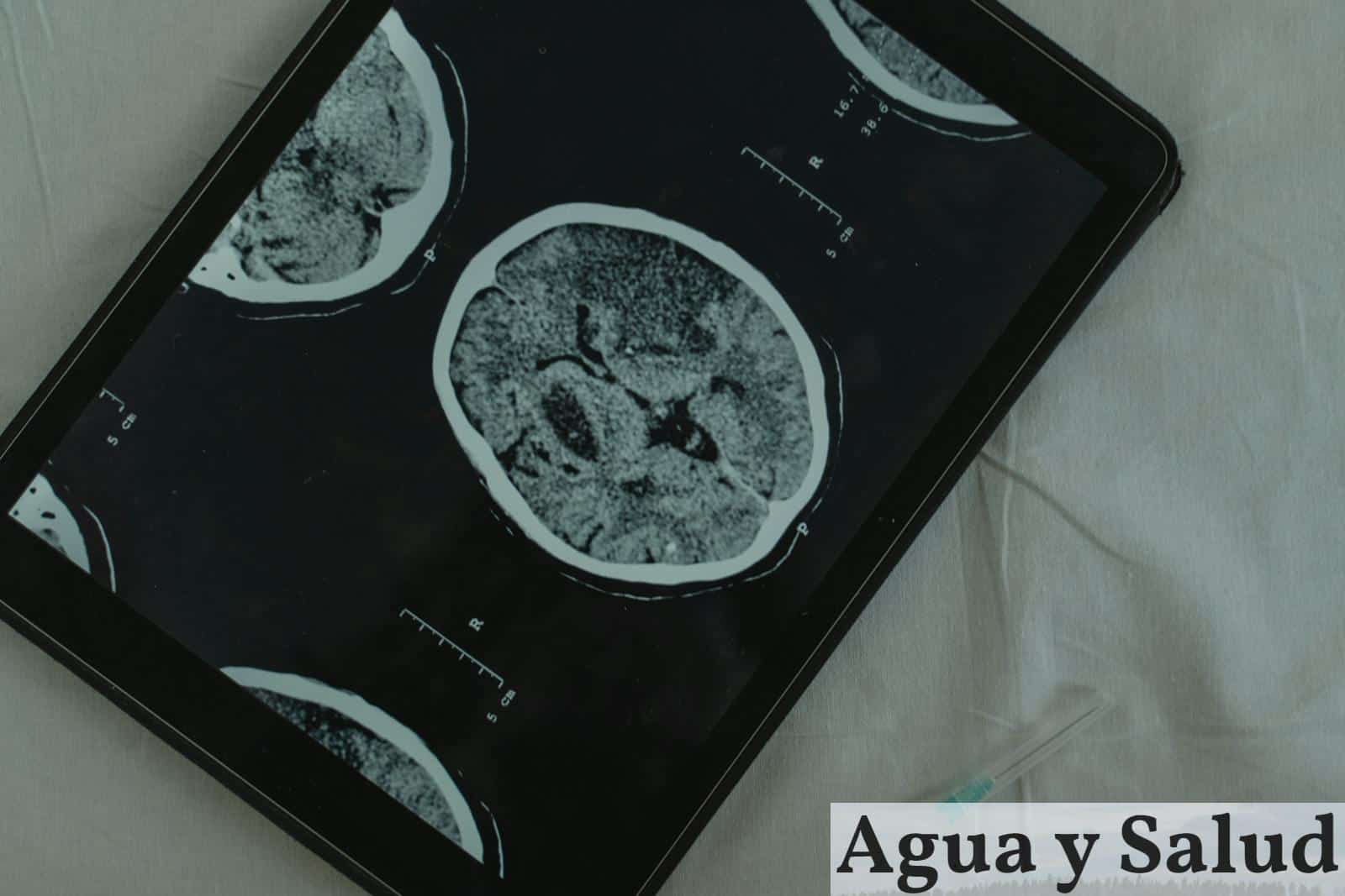Cerebro